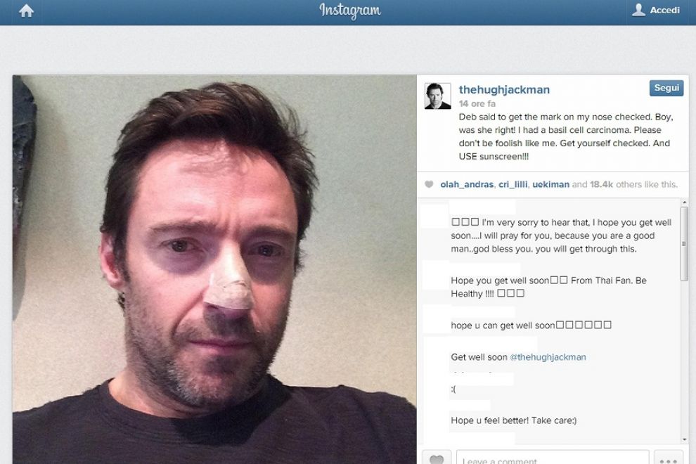 hugh-jackman